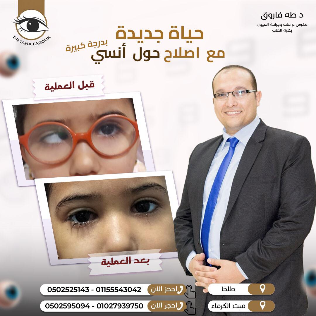 عمليات الحول: أنواعها ونتائجها المتوقعة